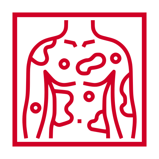 HAUTERKRANKUNGEN